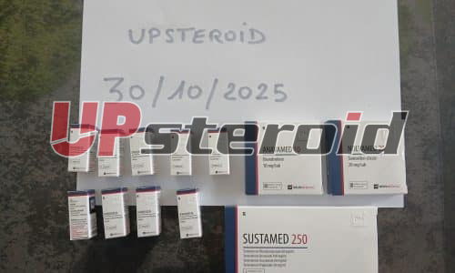 06/11/2025 - Metzeresche - FRANCE