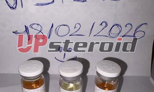 26/02/2026 - Dijon - France